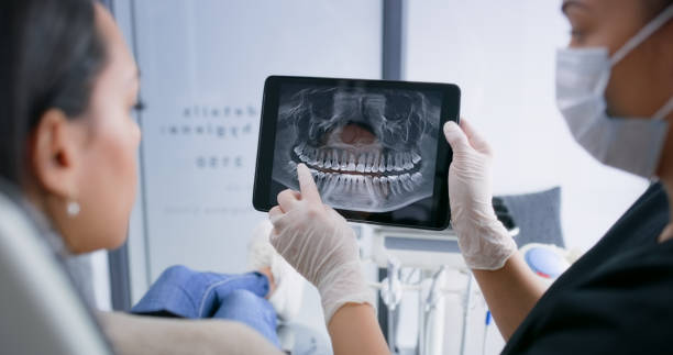 Licensed Dental Implants service in Watchung, NJ - Smile Center Dentistry