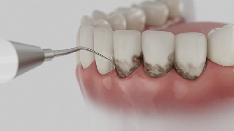 Reliable Dental Implants contractor in Watchung, NJ by Smile Center Dentistry